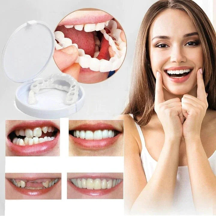 Snap-On Smile™ faner – Återanvändbara dental fasader för en strålande leende utan tandläkare